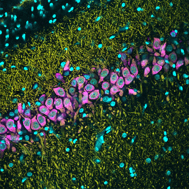 Proximodistal organization of CA2